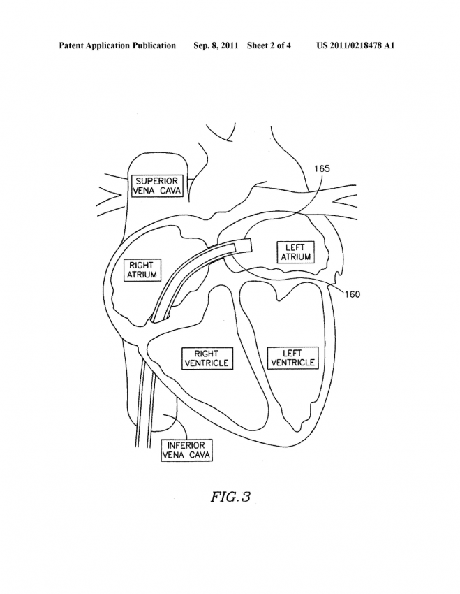 659x850 Cardiovascular System Coloring Pages