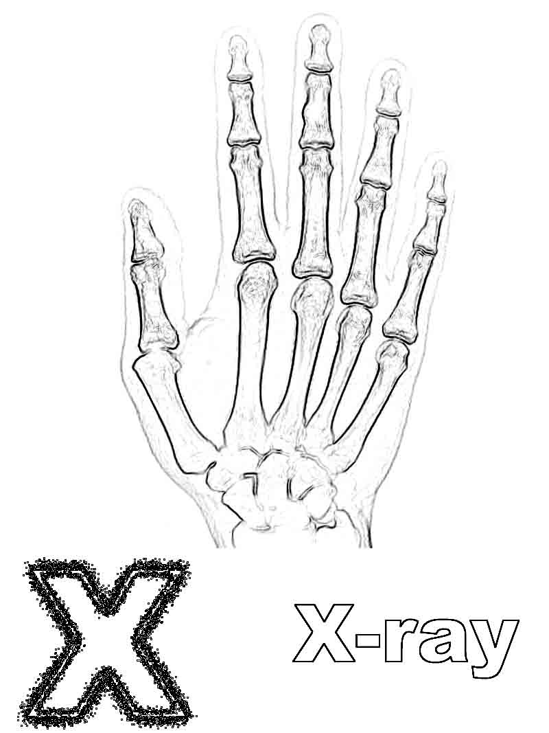 800x1067 X Is For X Ray